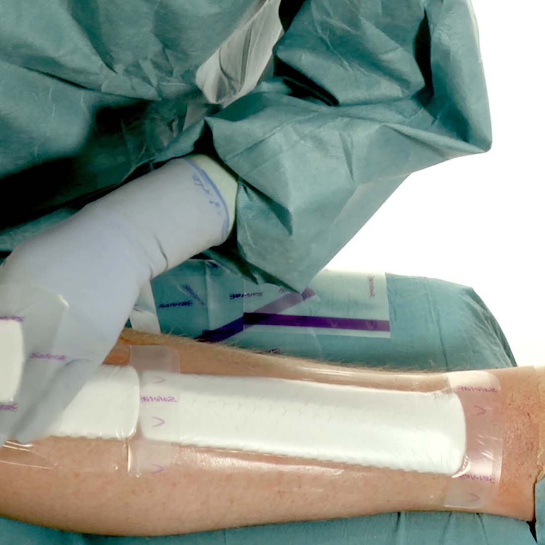 Curativo Pós-operatório Mepilex Border  Post-Op 10x35 Unidade - Imagem 6